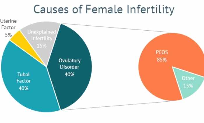 Female Infertility