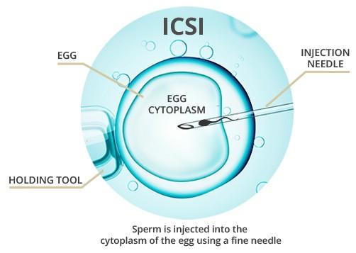 Pragati ICSI