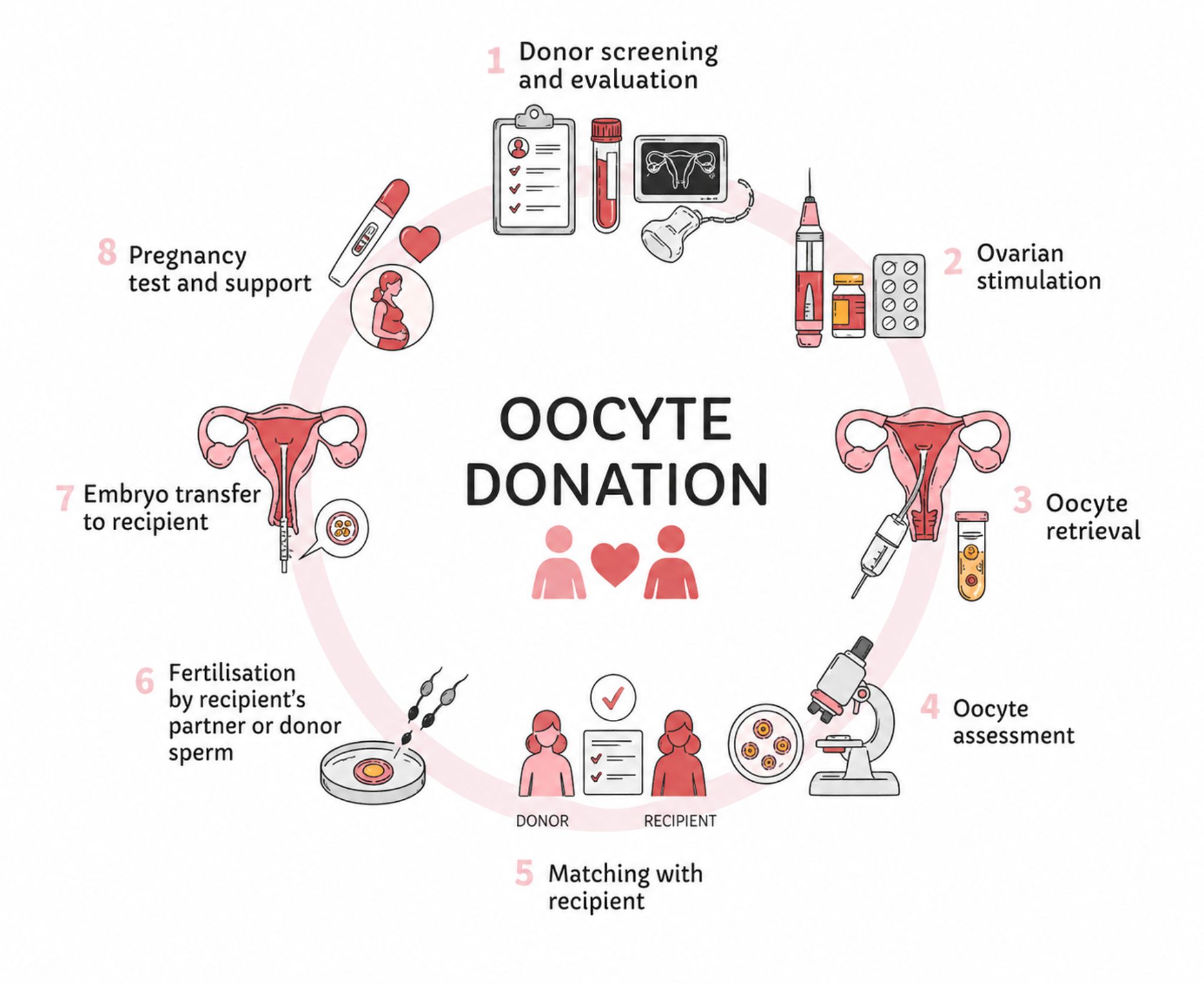 Oocyte Donation