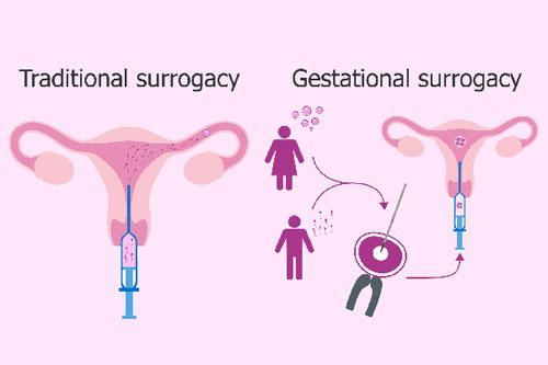 Surrogacy